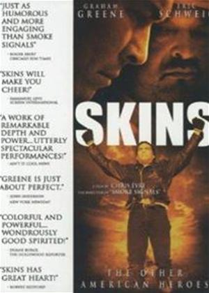 Rent Skins Online DVD Rental
